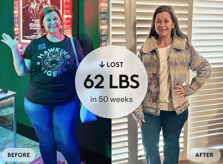 Jennifer L. before and after